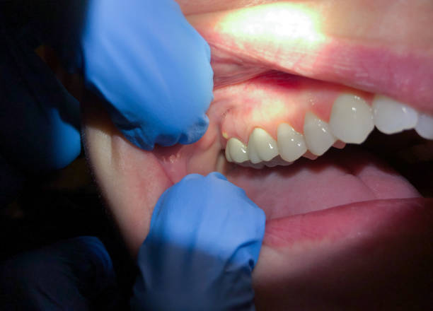 Best Weekend Emergency Dentist in Bloomfield, NY